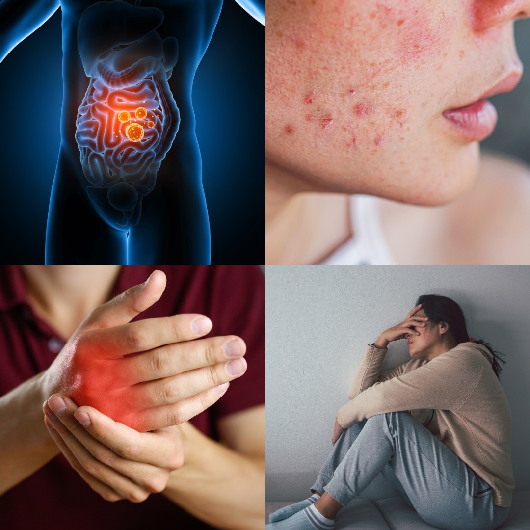 The Impact of Excess Inflammation on Your Body and Gut Health