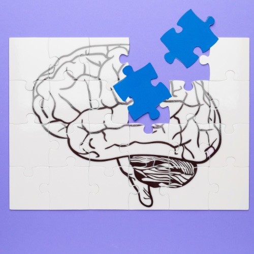 How to Reduce Your Risk of Brain Degeneration as You Age